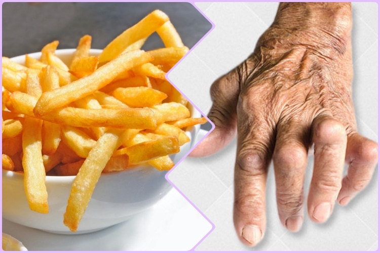 Alimentos Que Você Deve Evitar se Tiver Artrite Alimentos Que Você Deve Evitar se Tiver Artrite