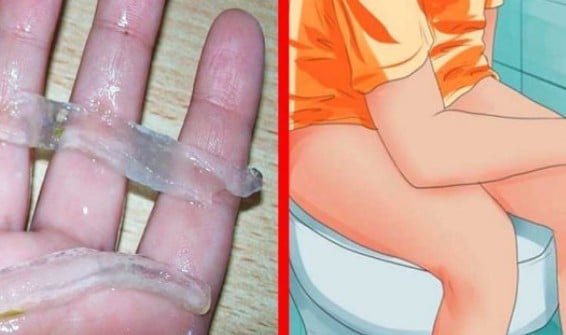 Acabe com as Hemorroidas Acabe com as Hemorroidas