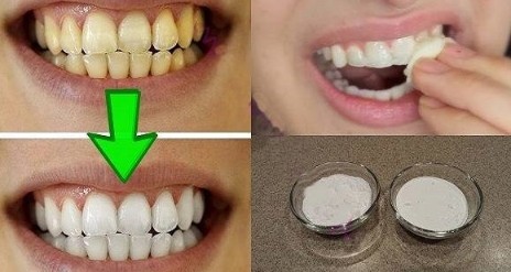 Clarear os Dentes em Casa Clarear os Dentes em Casa