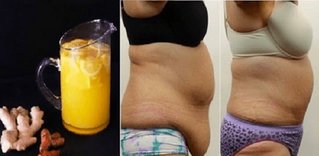 Eliminar a Barriga Flacida Eliminar a Barriga Flacida